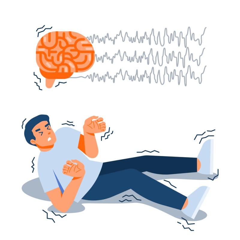 Epilepsy